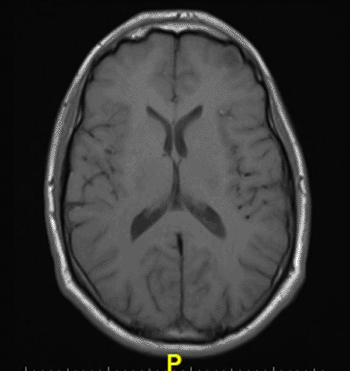 Image: A new study raises the possibility that a toxic component of the contrast agent may remain in the body long after administration (Photo courtesy of Radiology).
