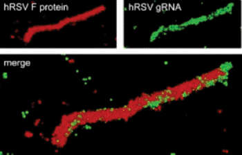 Image: A super-resolution optical image of a specific hRSV viral filament produced with dSTORM technology. The viral filament is approximately 4 microns in length, typical of hRSV (Photo courtesy of Eric Alonas and Philip Santangelo).