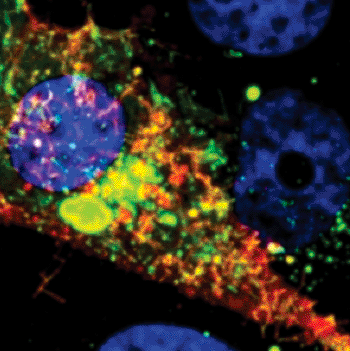 Image: Microscope image showing a cell infected with RSV. The RNA tagged by the probe is shown in red, while the nucleoprotein is green (Photo courtesy of Eric Alonas and Philip Santangelo).