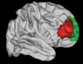 Image: An area (red) of the brain that seems to be unique to humans (Photo courtesy of the University of Oxford).