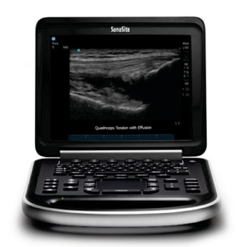 Image: The Edge point-of-care ultrasound system (Photo courtesy of Fujifilm SonoSite).