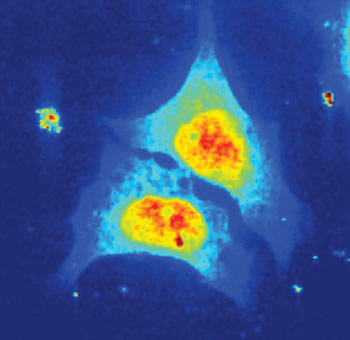 Image: X-ray scan of biologic cells: Each pixel represents a complete diffraction image. The color indicates how strong the X-rays are scattered at this local point (Photo courtesy of Britta Weinhausen, the University of Göttingen).