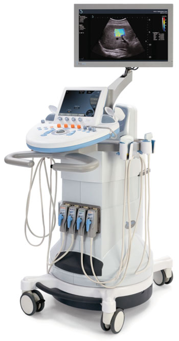 Image: The Aixplorer ultrasound with MultiWave technology (Photo courtesy of SuperSonic Imagine).