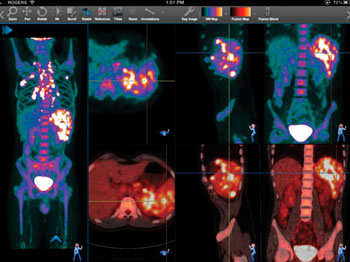 Image: Claron’s NilRead zero-footprint viewer was designed for the diagnostic interpretation of medical images (Photo courtesy of Claron Technology).