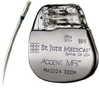 Image: The Accent MRI pacemaker and Tendril MRI lead (Photo courtesy of St. Jude Medical).