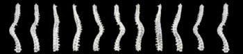 Image: CT image shows the complete skeleton showing the curve of the spine (Photo courtesy of the University of Leicester).