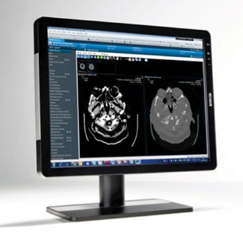 Image: 21-inch clinical review display (Photo courtesy of Barco).