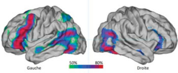 Image: Probability map of the brain regions activated in functional magnetic resonance imaging (fMRI) by a silent sentence production task in a group of 144 right-handed individuals. The color scale indicates the percentage of subjects with significant activation in this area during the task (green: 50%, blue: 65%, red: 80% or more). Note the high asymmetry of the map in favor of the left hemisphere) [Gauche = Left, Droite = Right] (Photo courtresy of Groupe d\'Imagerie Neurofonctionnelle, CNRS/CEA/Université de Bordeaux, France).