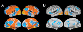 Image: fMRI scans across all subjects in the study. The yellow and red areas in section A represent parts of the brain that are activated while subjects are forming “gist memories” of pictures viewed. Section B represents areas of increased activation, shown in yellow and red, as detailed memories are being formed (Photo courtesy of Jagust Lab).