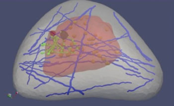 Image: A “virtual breast” image is part of a software program designed by Michigan Tech’s Jingfeng Jiang. Healthcare professionals could use the software to learn how to better read ultrasound elastography images, which are used to detect cancer (Photo courtesy of Michigan Technological University).