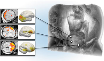 Image: Separated bilateral occipital, unilateral temporal and bilateral frontal activations overlaid onto a brain model of the fetus (MRI reconstruction) (Photo courtesy of Medical University of Vienna).