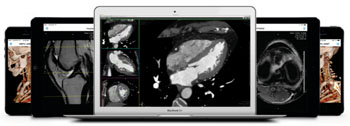 Image: The ResolutionMD enterprise image viewer provides rapid access to diagnostic images from any mobile or web device (Photo courtesy of Calgary Scientific).