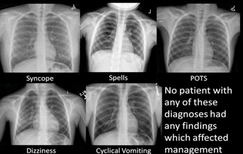 Image: No patients with any of these (syncope, spells, POTS, Dizziness, cyclical vomiting) diagnoses had any findings which affected management (Photo courtesy of RSNA).