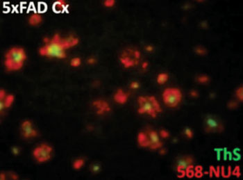 Image: Amyloid beta oligomers bind to neurons and are distinct from amyloid plaques. Brain sections from an aged Alzheimer’s mouse model were probed with antibodies against Abeta oligomers (568-NU4, red) and amyloid plaques (ThioS, green). Images demonstrate that Abeta oligomers (568-NU4) are often associated with, yet distinct from, amyloid plaques (ThioS). Where both amlyoid plaques (green) and A-beta oligomers (red) overlap, shows up as yellow. NU4 labelling is more abundant than the ThioS staining. Data supports the notion that NU4 thus affords an excellent targeting antibody for the development of an amyloid beta oligomer-specific MRI probe that is distinct from currently available plaque probes (Photo courtesy of an adaption from Viola et al, Nature Nanotechnology, 2014).