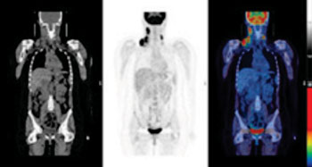 Image: PET scan images (Courtesy of King’s College London).