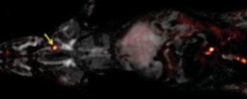 Image: The whole body of a rat can be imaged for blood clots with one PET scan, overlaid here on an MRI image, using the FBP8 probe. The arrow points to a blood clot (Photo courtesy of the American Chemical Society).