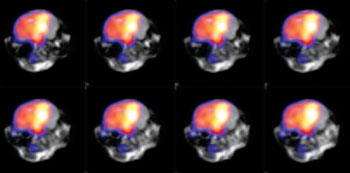 Image: Simultaneous PET/MRI imaging offers benefits to cardiovascular, neurobiology, cancer, and other researchers (Photo courtesy of MR Solutions).