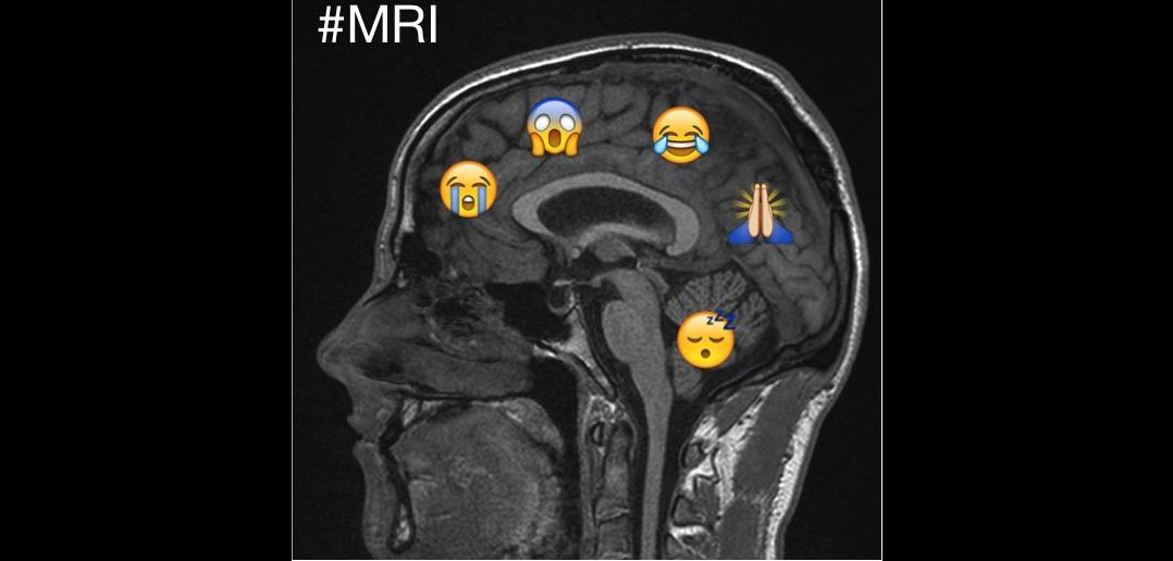 Image: MRI of Johnathan Hewis' brain. Mr. Hewis was quoted as saying, “Had a lovely nap in the MRI machine” (Photo courtesy of Johnathan Hewis).