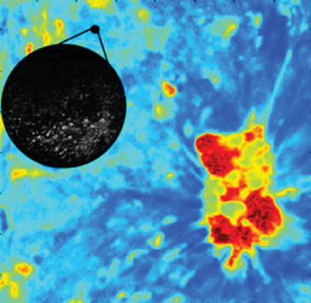 Image: FLIM microscopy detecting oral cancer (Photo courtesy of Texas A&M University).