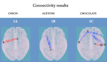 Image: The different connections found in the brains of normal weight children compared to those in obese children when presented with various food odors (Photo courtesy of RSNA).