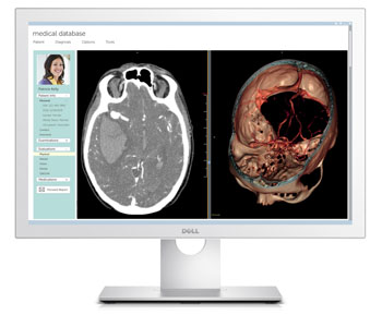 Image: Dell Medical Review 24 Monitor (MR2416) is the company’s first monitor purpose-built for the healthcare environment (Photo courtesy of Dell).