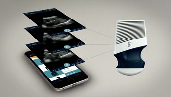 Image: The Clarius handheld ultrasound scanner (Photo courtesy of Clarius Mobile Health).