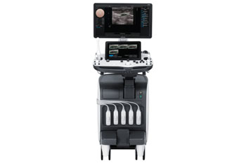 Image: The RS80A with Prestige ultrasound system (Photo courtesy of Samsung Medison).