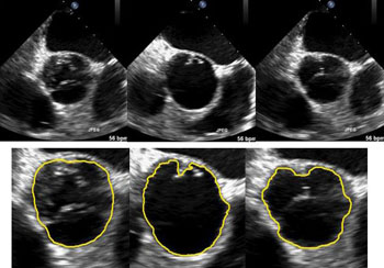 Image: The image shows selected, original, ultrasound images and the results of Region of Interest (ROI) tracking using a wavelet variational model (Photo courtesy of Xiaoqun Zhang).