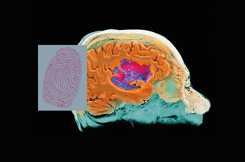Image: MR Fingerprinting (MRF) can be used to identify individual tissues and diseases quantitatively (Photo courtesy of Siemens Healthcare).