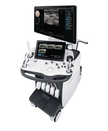 Image: The RS80A with Prestige ultrasound device (Photo courtesy of Samsung).