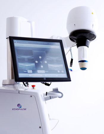 Image: The Ecopulse medical device for the treatment of BFAs and benign thyroid nodules (Photo courtesy of Theraclion).