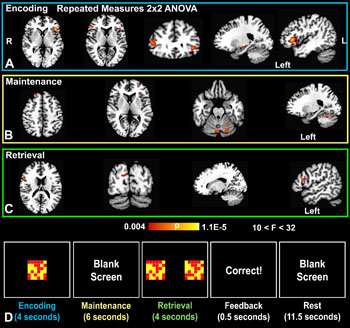 Image: The results of a novel study investigating the effects of methylene blue on short-term memory (Photo courtesy of RSNA).
