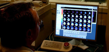 Image: PET imaging of adult neurogenesis may contribute to better diagnosis of depression (Photo courtesy of NIMH).