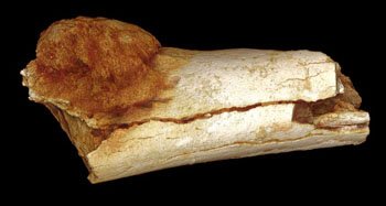 Image: A bony growth on the toe of a hominid from between 1.6 million and 1.8 million years ago (Photo courtesy of P. Randolph-Quinney/UCLAN).