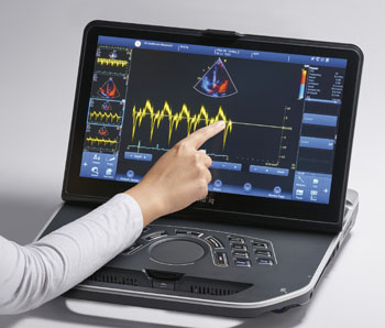 Image: The Vivid iq portable ultrasound (Photo courtesy of GE Healthcare).