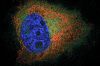 Image: A fluorescence image of a HeLa cell with PA labeled with a green fluorescent dye (Photo courtesy of Timothy Bumpus / Cornell).