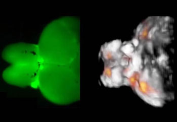 Image: Typical images acquired from an adult zebrafish brain – a fluorescence image on the left, and a functional optoacoustic tomography image on the right (Photo courtesy of Helmholtz Zentrum München).