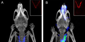 Image: The images demonstrate the use of activity-based probes using optical and PET/CT methods, to detect early signs of atherosclerotic plaques (Photo courtesy of Xiaowei Ma, Toshinobu Saito and Nimali Withana).