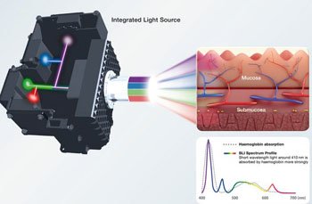 Image: The 4-LED light source of the ELUXEO endoscopy system (Photo courtesy of Fujifilm).