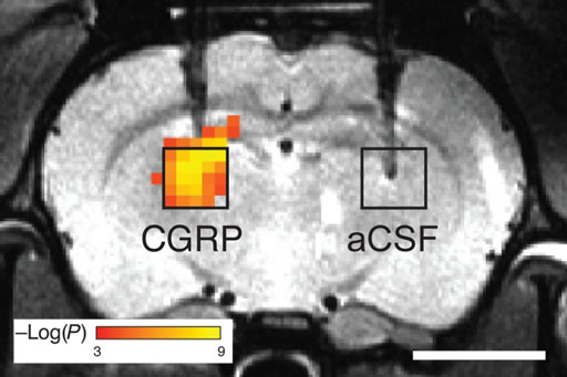 Image: CGRP-based sensors dilate blood vessels in the brain to make them visible on MRI (Photo courtesy of Alan Jasanoff / MIT).