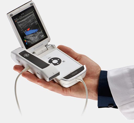 Image: The Vscan pocket-sized ultrasound scanner (Photo courtesy of GE Healthcare).