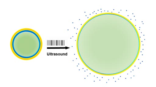 Image: The new technology uses non-invasive ultrasound waves to deliver drug-laden nano-particles (left) with a liquid center (green) that turns to gas and releases the therapeutic drug (blue) (Photo courtesy of Raag Airan).