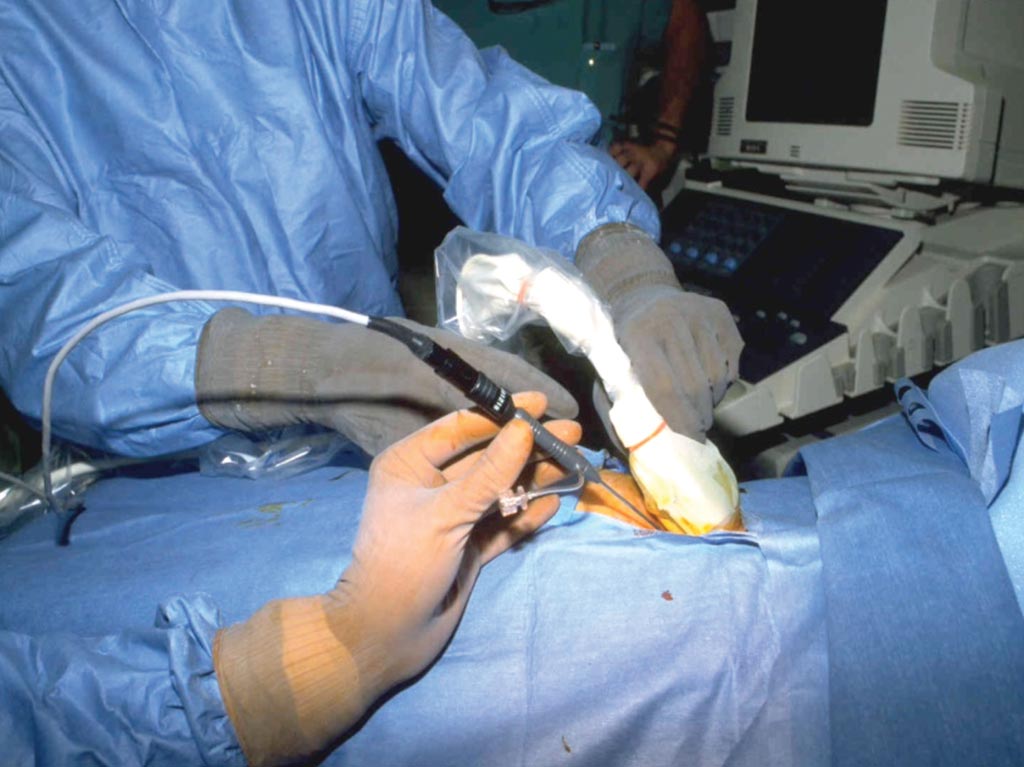 Image: The IOUS in use for guiding interventional procedure (Photo courtesy of SonoScape).