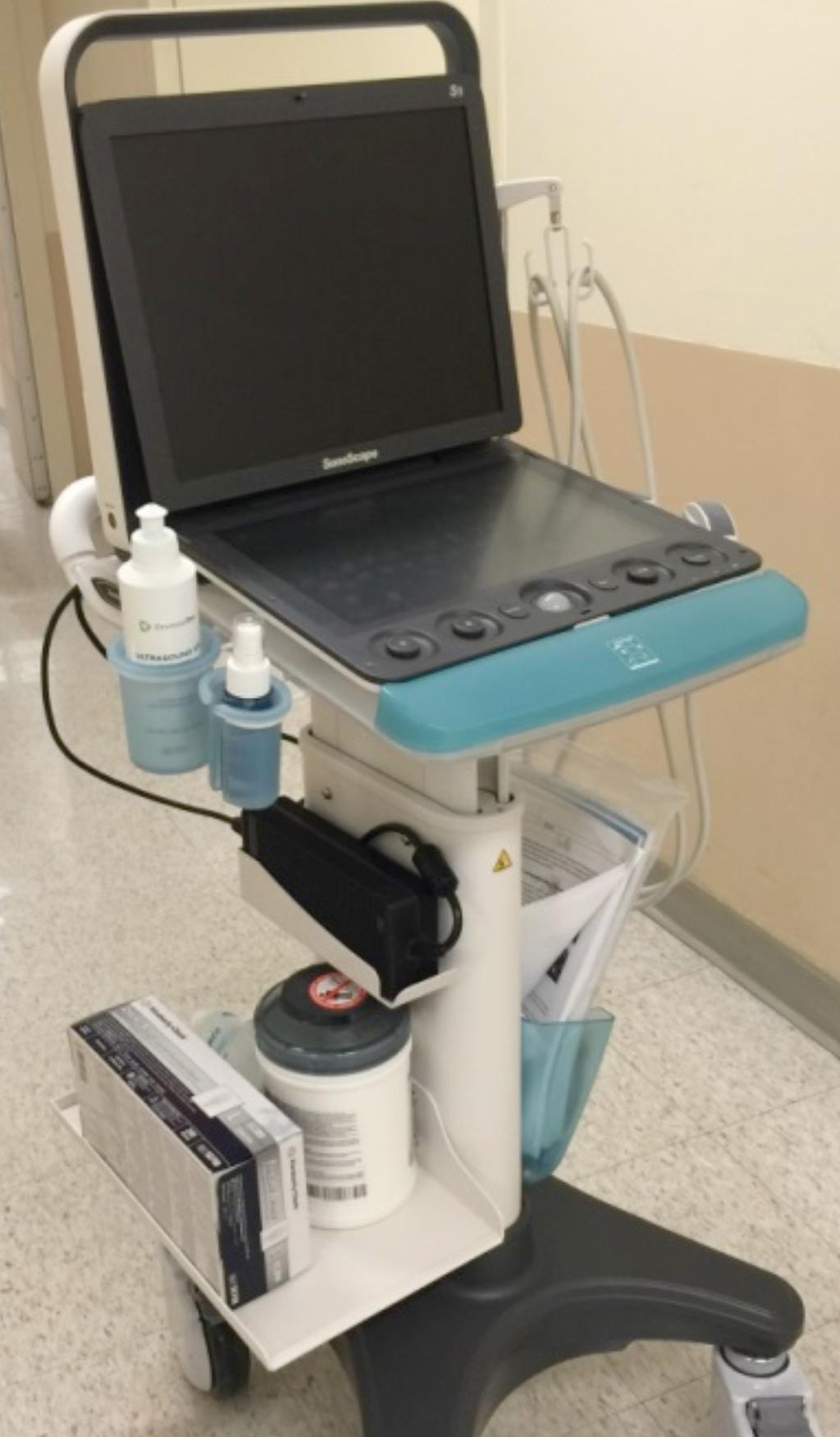 Image: The S9 portable ultrasound system (Photo courtesy of SonoScape).