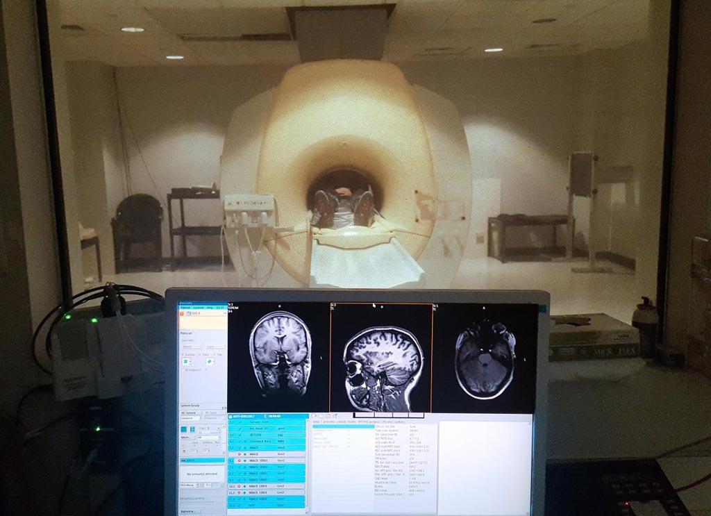 Image: One of the participants in an MRI scanner during the study (Photo courtesy of Boston University Medical School Center for Biomedical Imaging).
