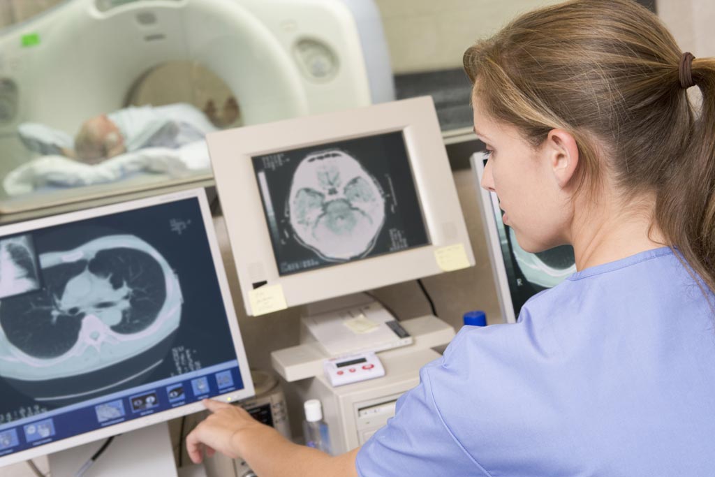 Image: Research shows CT imaging could help detect immune-related colitis (Photo courtesy of Alamy).