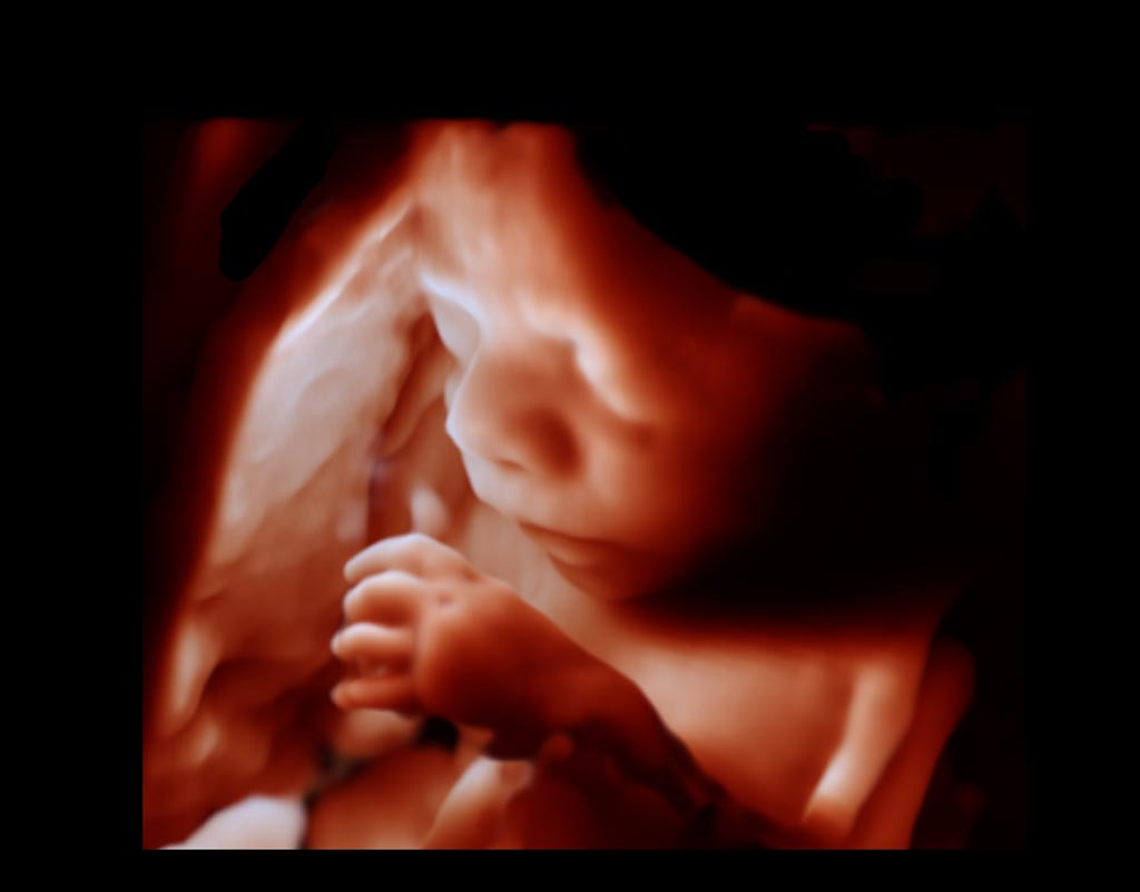 Image: New visualization tools include TrueVue, which uses a virtual light source to provide more lifelike 3D ultrasound images (Photo courtesy of Philips Healthcare).