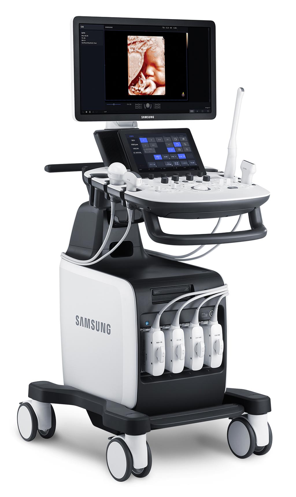 Image: The new mid-range HS60 ultrasound system that includes advanced high-end technologies (Photo courtesy of Samsung).