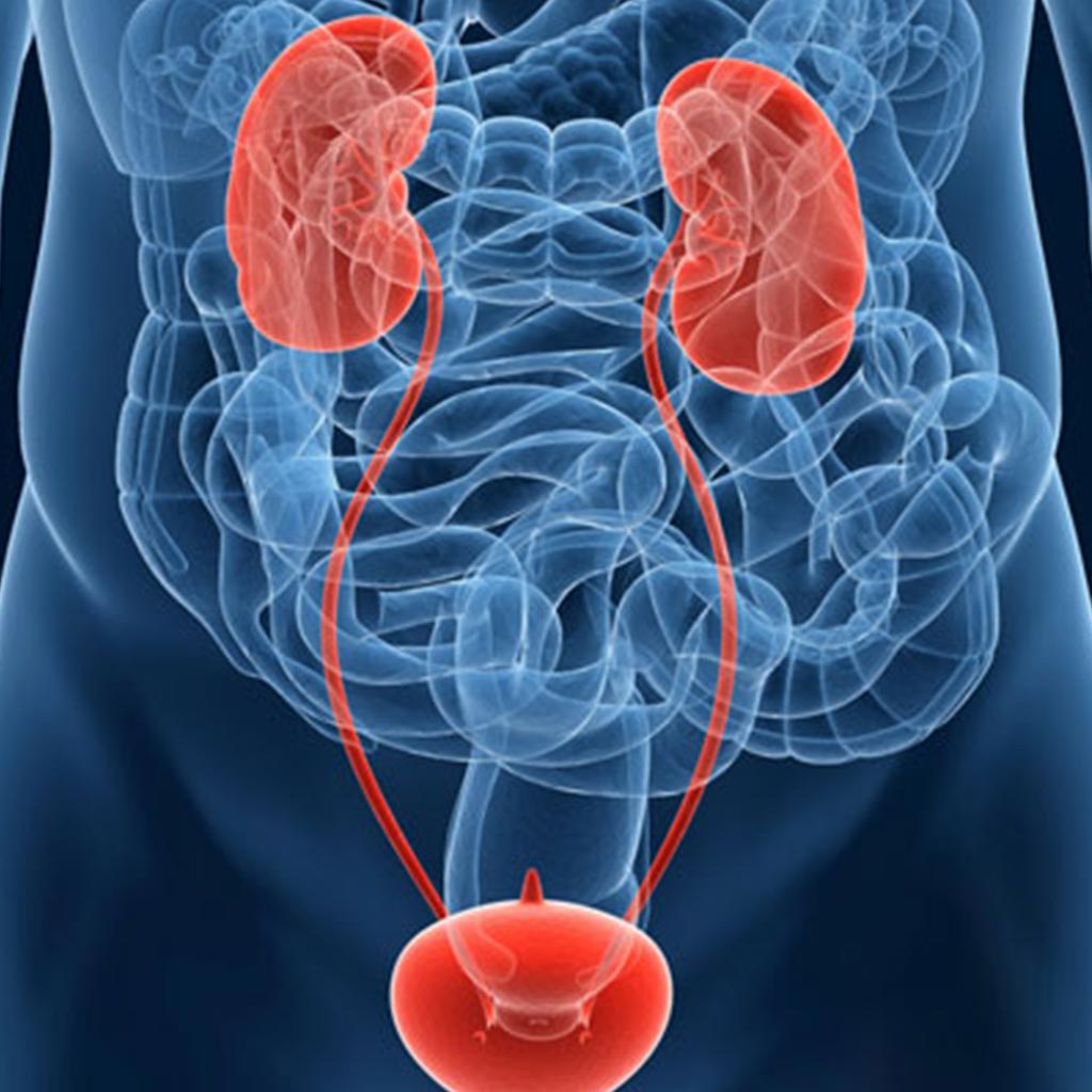 Study Investigates Survival Rates of Bladder Cancer