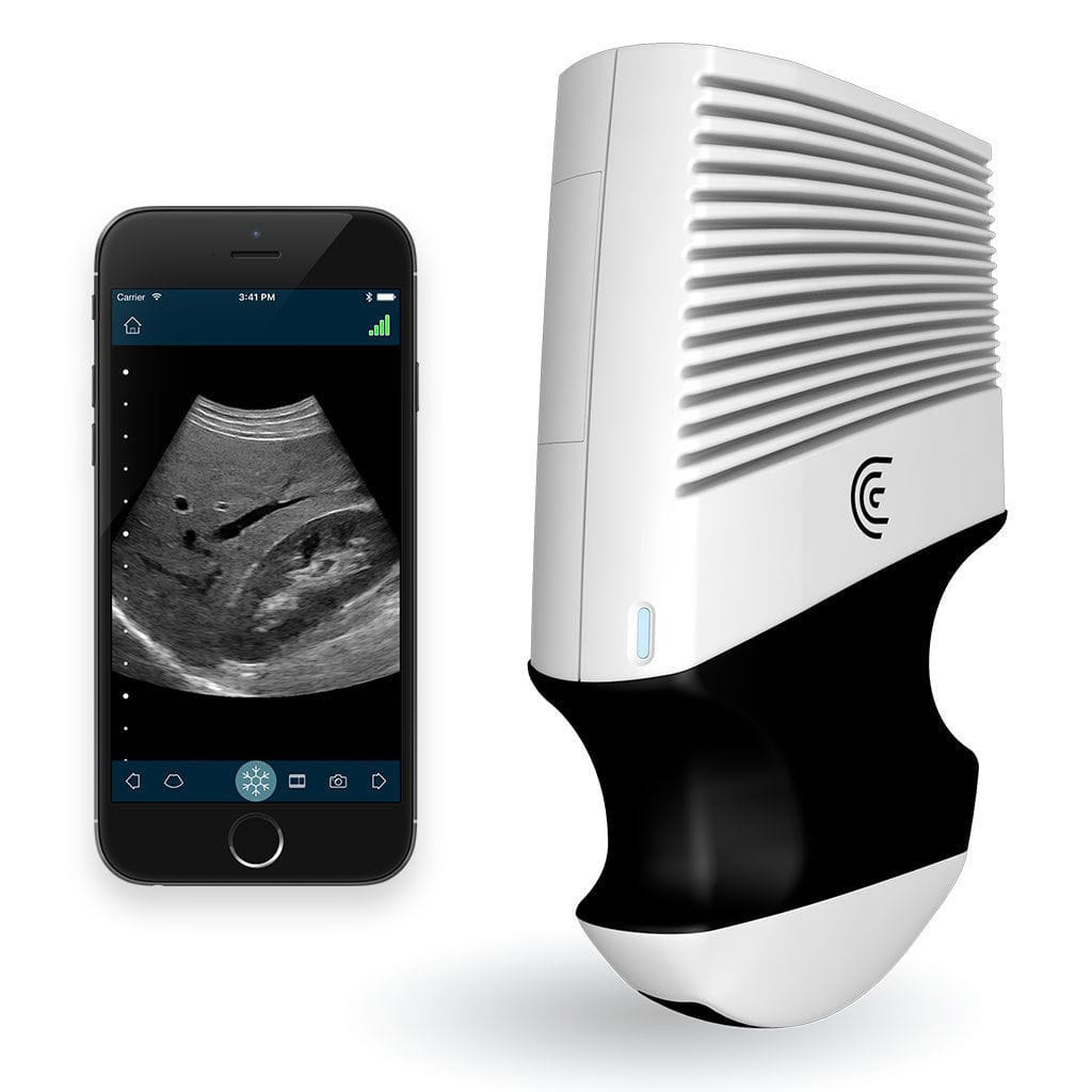Image: The Clarius C3 handheld ultrasound scanner (Photo courtesy of Clarius Mobile Health).